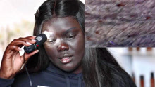 非洲美女用显微镜，将自己的皮肤放大100倍，竟发现了这个东西！